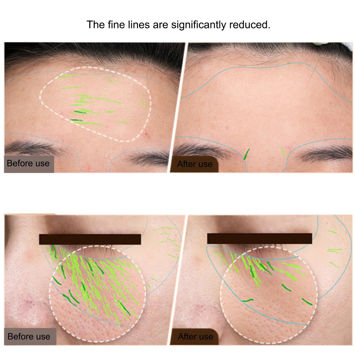 GLOWTECHS™ EMS Facial Sculpting Pro