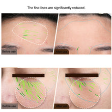 GLOWTECHS™ EMS Facial Sculpting Pro