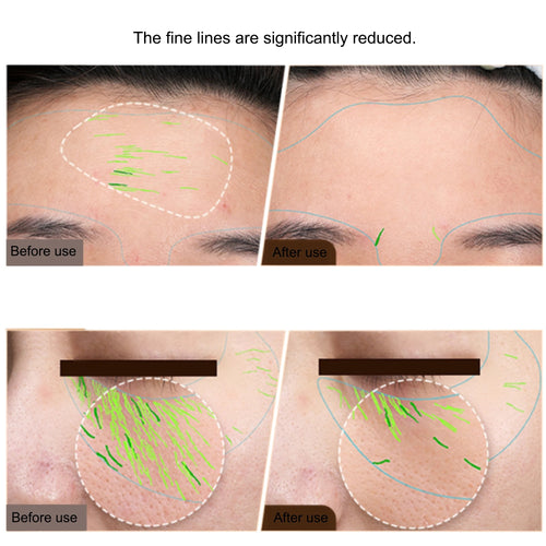 GLOWTECHS™ EMS Facial Sculpting Pro